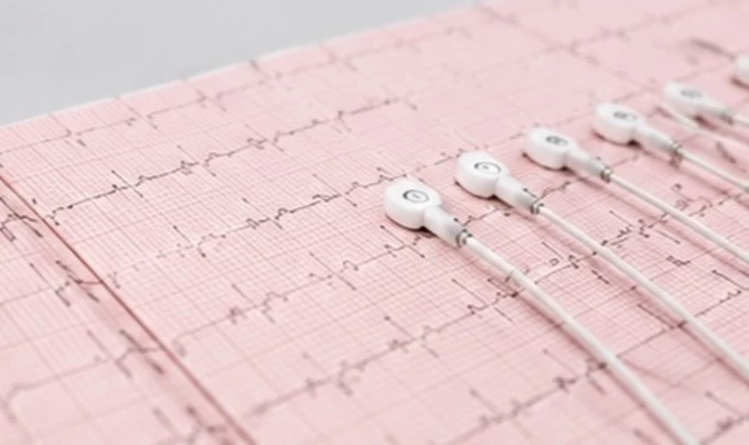 12 csatornás komputeres EKG